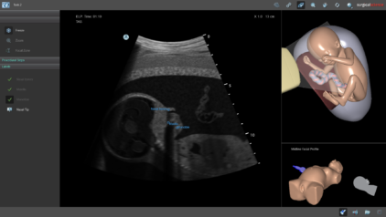 Midline Facial Profile - Label Task