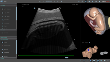Spine Sagittal