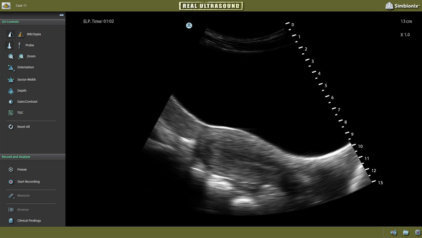 Transabdominal - Uterus