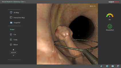 Second Module Colonoscopy