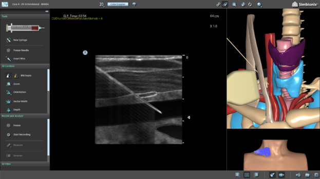 Central Line - Surgical Science