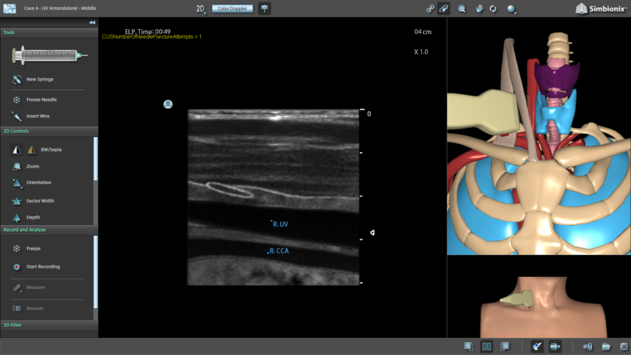 Central Line - Surgical Science