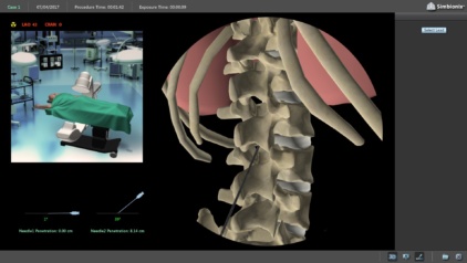 SCS-3D Anatomical Map