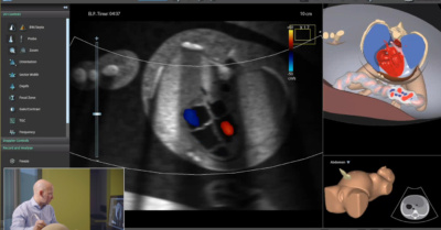 Mastering Fetal Echo Training, A Key to Sonography Success