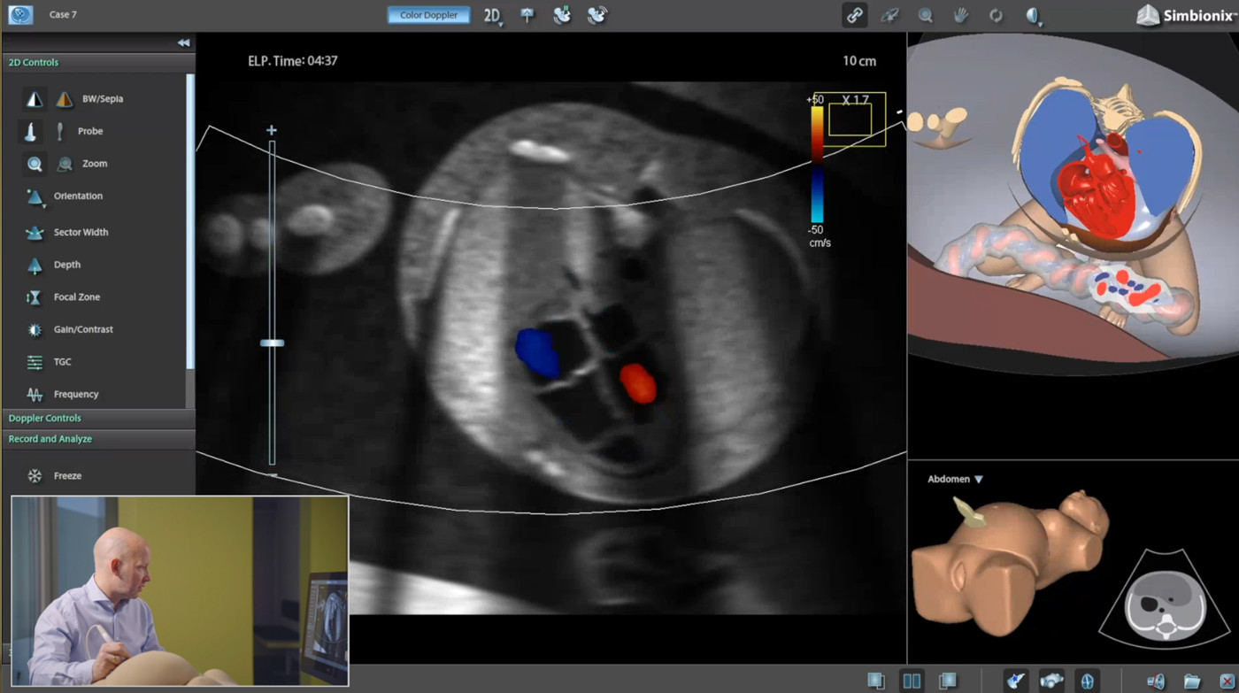 Mastering Fetal Echo Training, A Key to Sonography Success