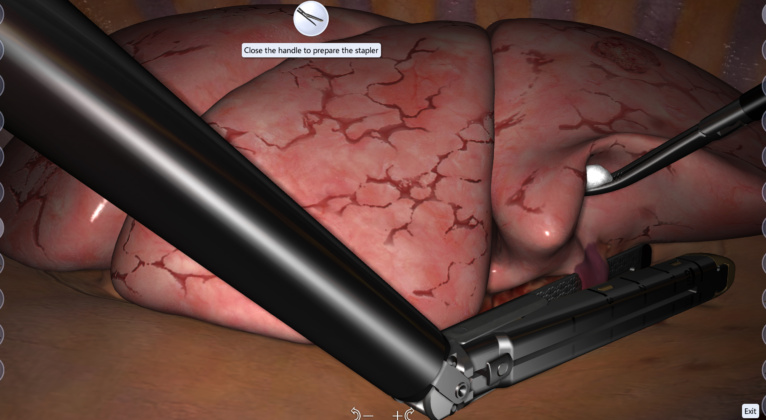 VATS lobectomy simulation by Surgical Science