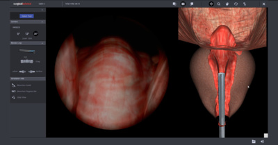 New TURP Modules for URO Mentor Simulator