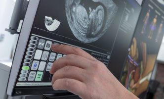 University of Hertfordshire achieves 100% transvaginal pass rate with ScanTrainer University of Hertfordshire achieves 100% transvaginal pass rate with ScanTrainer