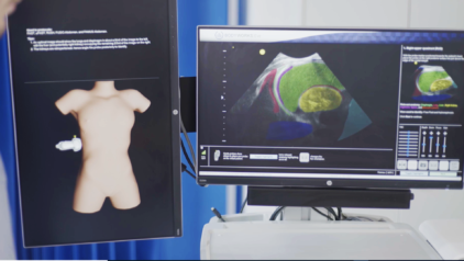 BodyWorks Eve Scanning Windows