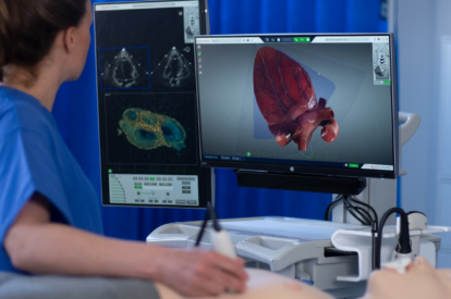 Live 3D Echo Module