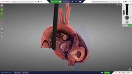 ME Bicaval 3D with probe