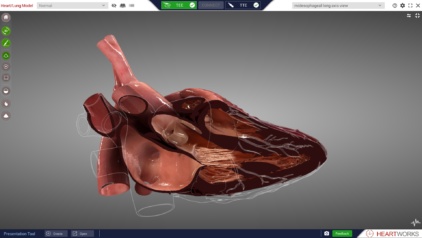 ME LAX 3D without probe