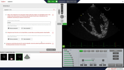 START screenshot 3